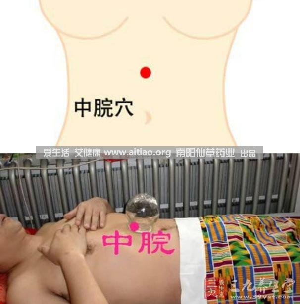 中脘穴位于腹部正中線，臍上4寸的位置上。每天艾灸10-15分鐘，能有效緩解胃部不適的癥狀，同時有助于祛濕。